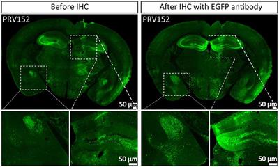 Optimization of the Fluorescent Protein Expression Level Based on Pseudorabies Virus Bartha Strain for Neural Circuit Tracing